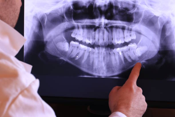Best Emergency Tooth Extraction in St Maries, ID